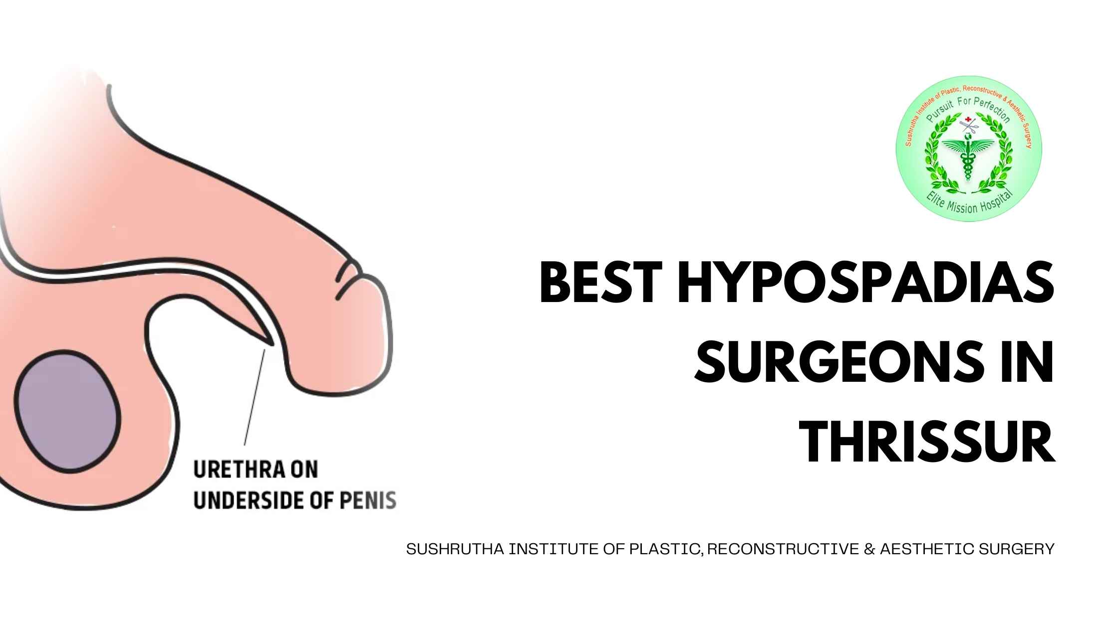 Best Hypospadias Surgeons in Thrissur - Expert Care at Sushrutha Institute of Plastic, Reconstructive & Aesthetic Surgery