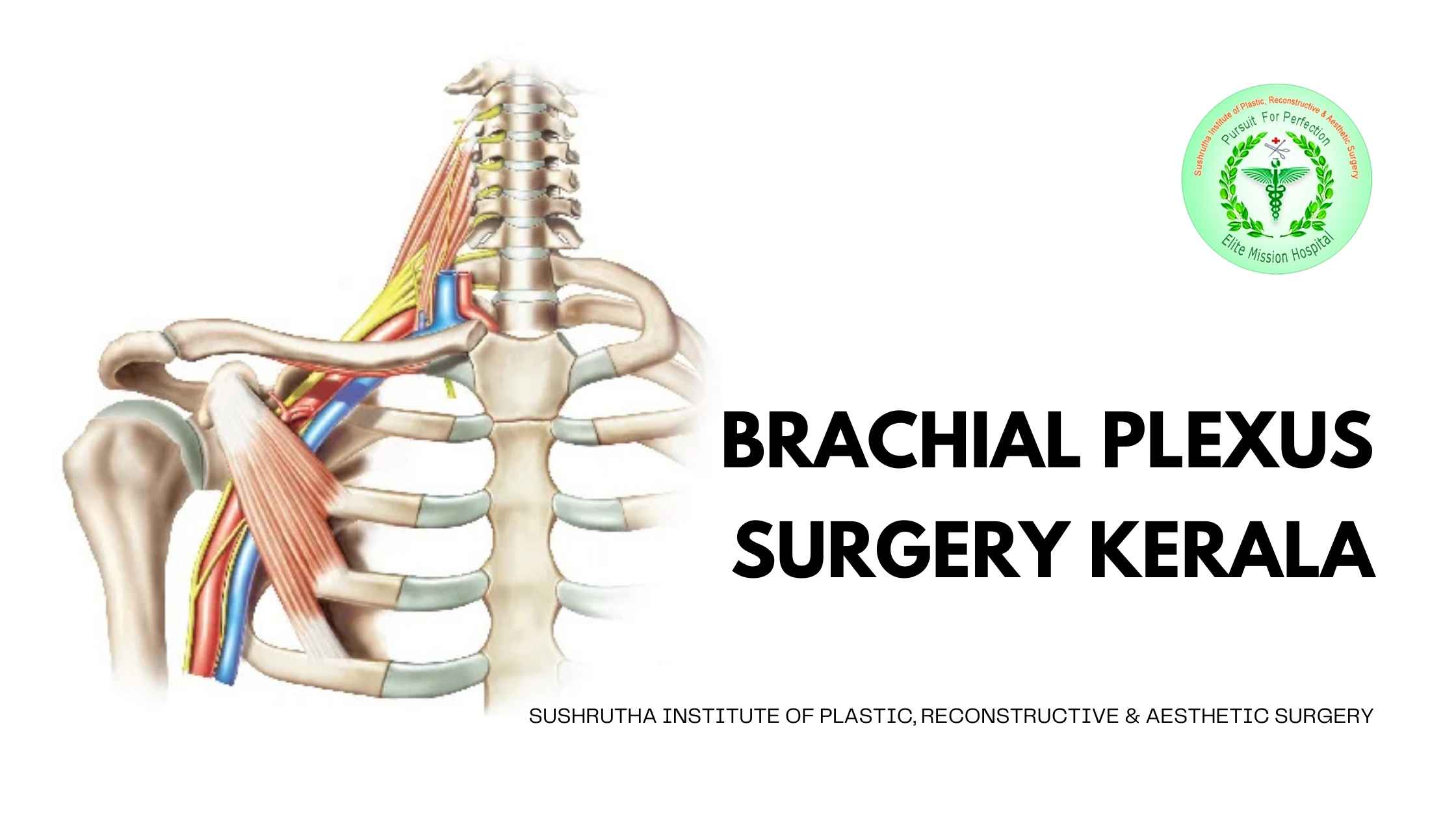 Brachial Plexus Surgery at Sushrutha Institute in Kerala