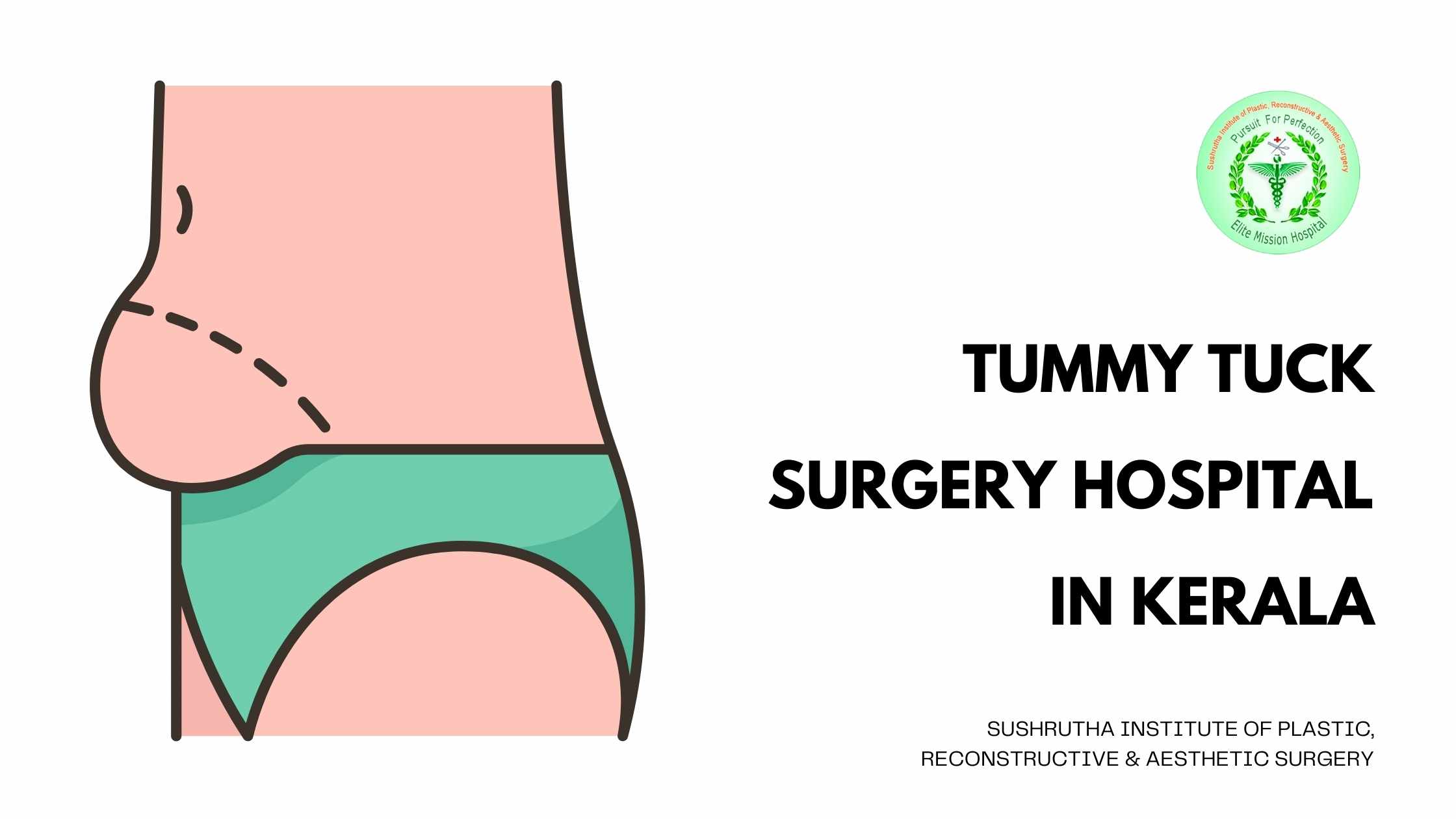 Tummy tuck surgery at Sushrutha Institute of Plastic, Reconstructive & Aesthetic Surgery, Kerala