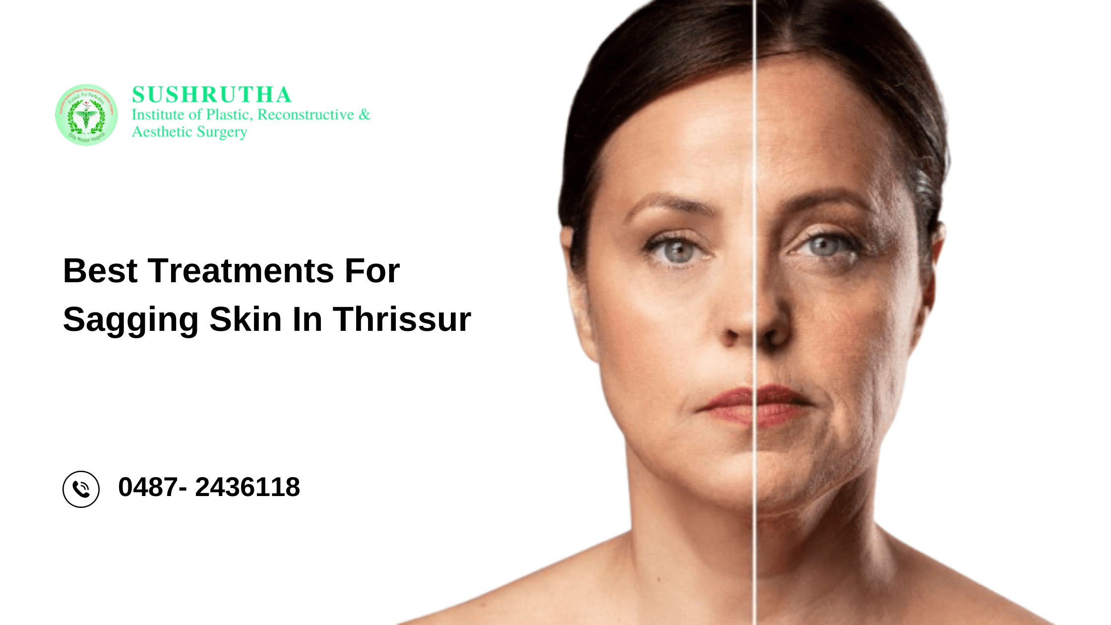 "Restore your youthful appearance with the best treatments for sagging skin at Sushrutha Institute in Thrissur."