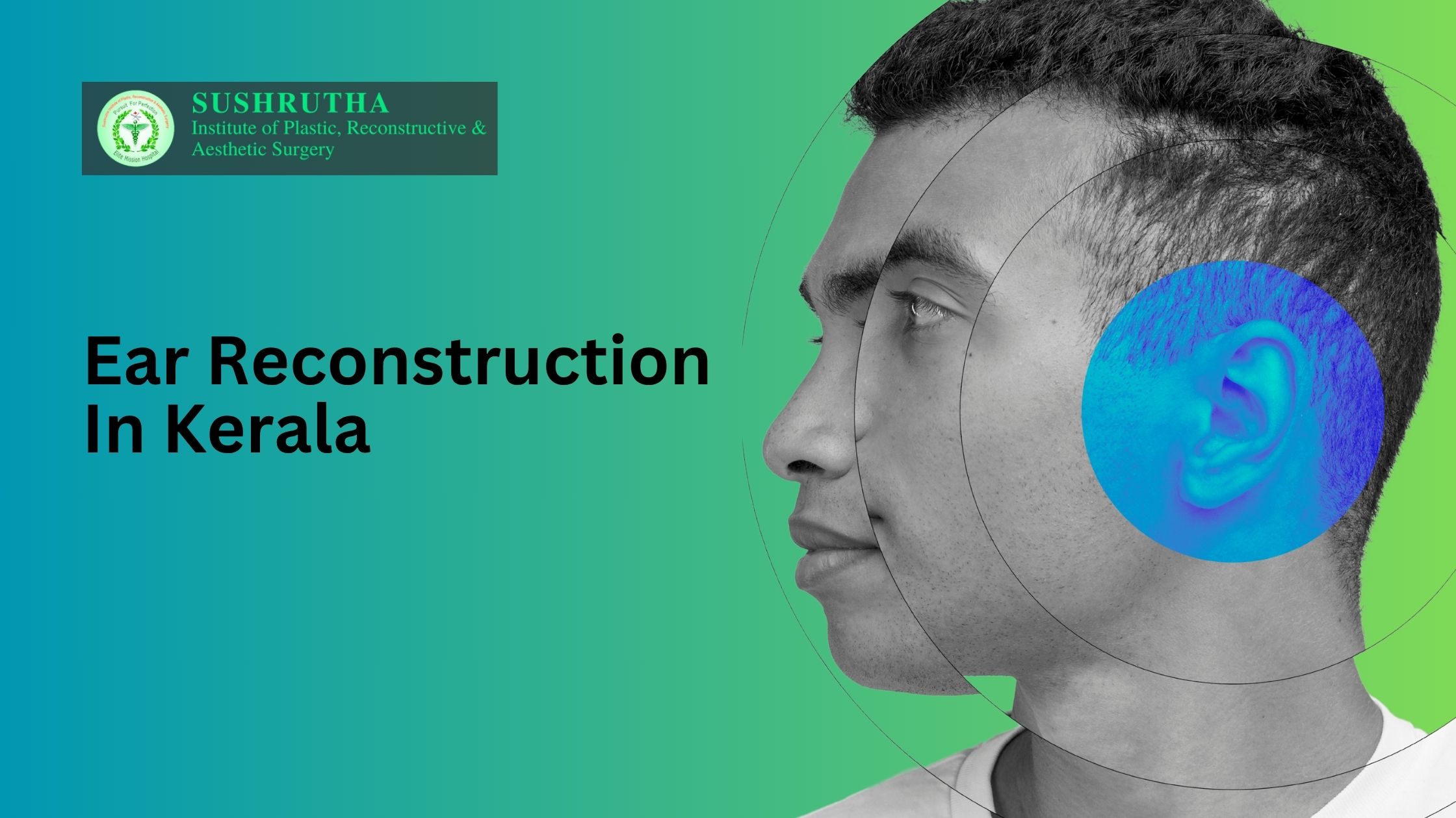 ear reconstruction Kerala