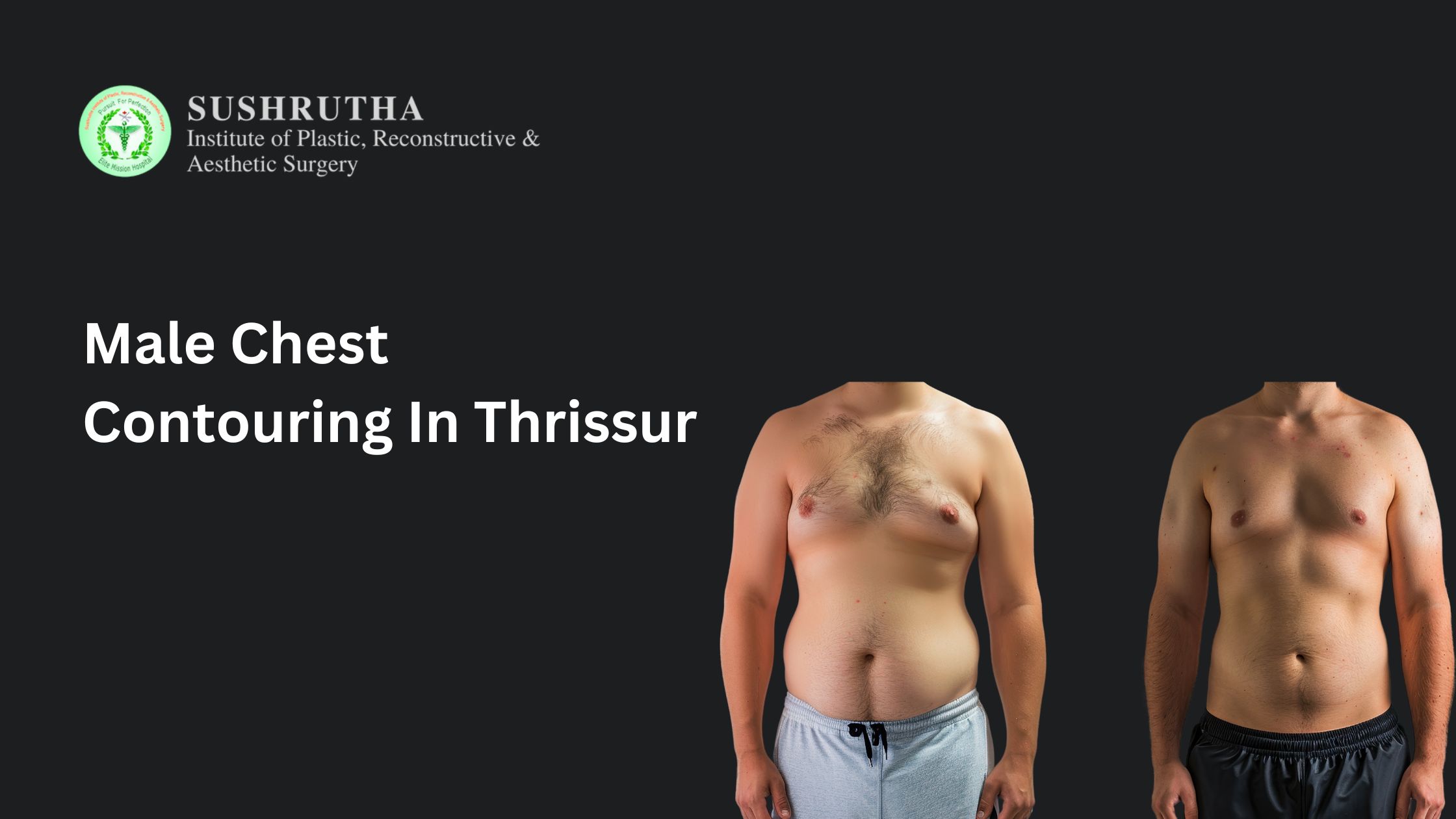Before and after results of male chest contouring in Thrissur showing a flatter, sculpted chest.