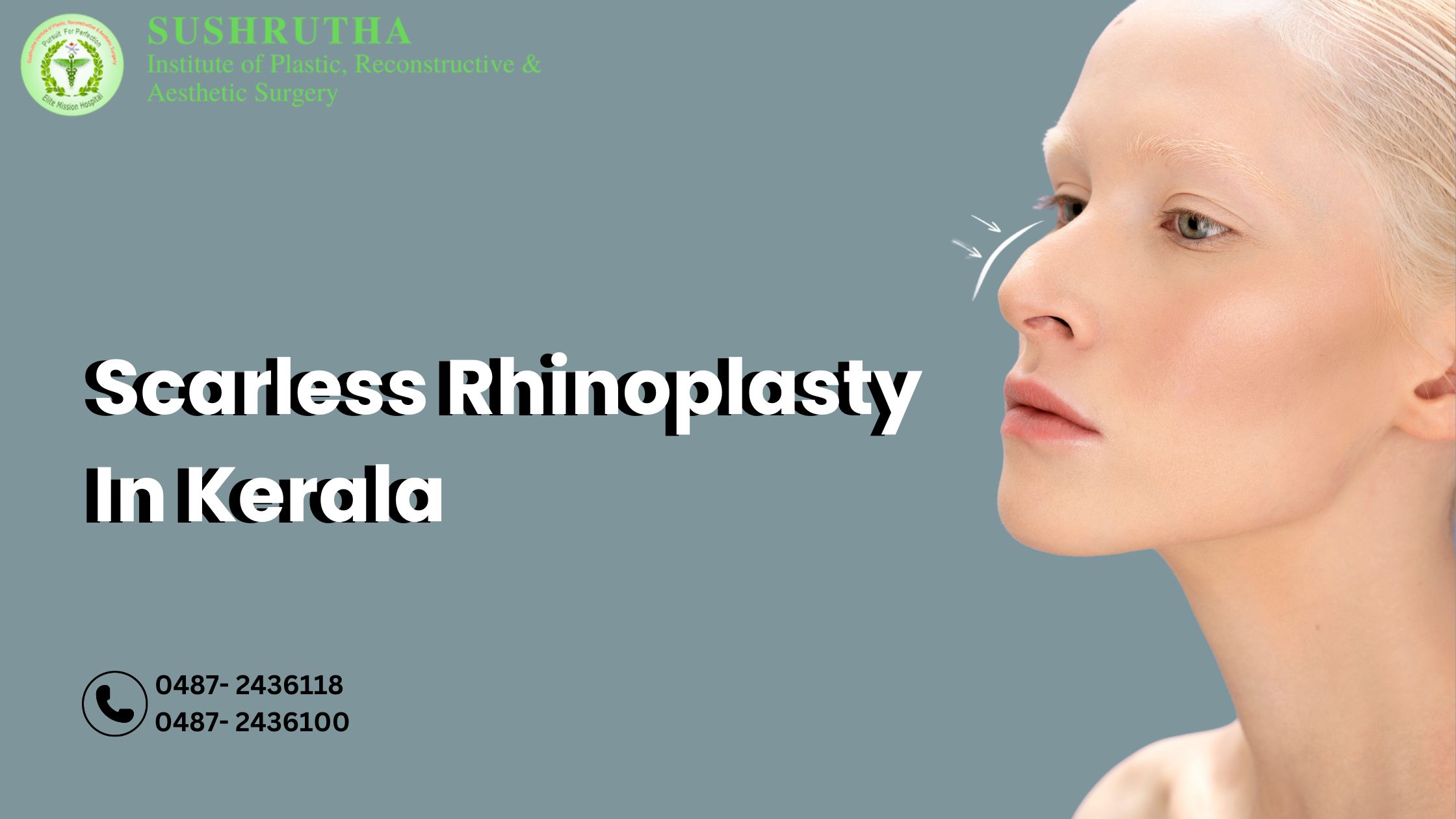 Scarless Rhinoplasty in Kerala