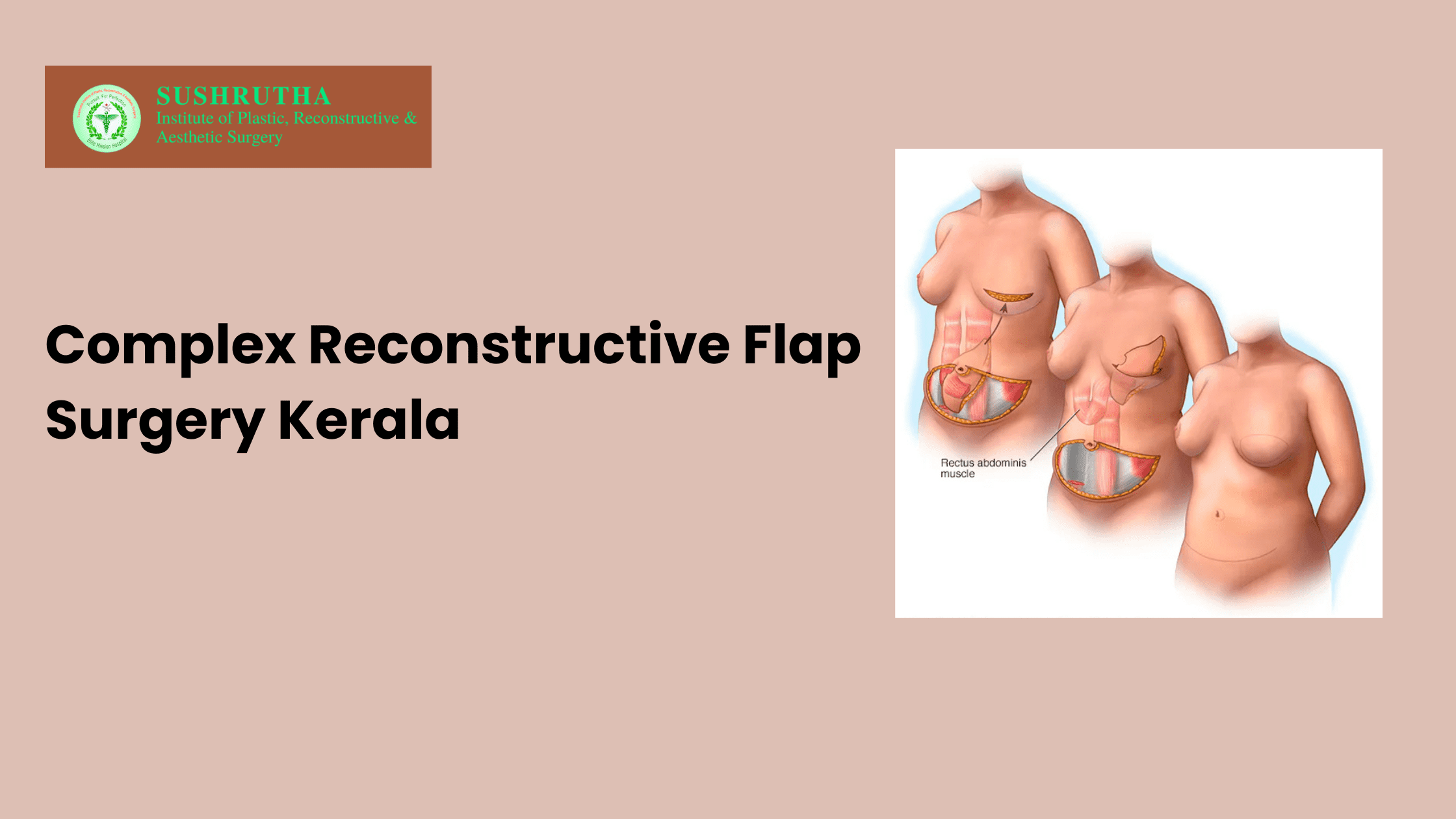 complex reconstructive flap surgery Kerala