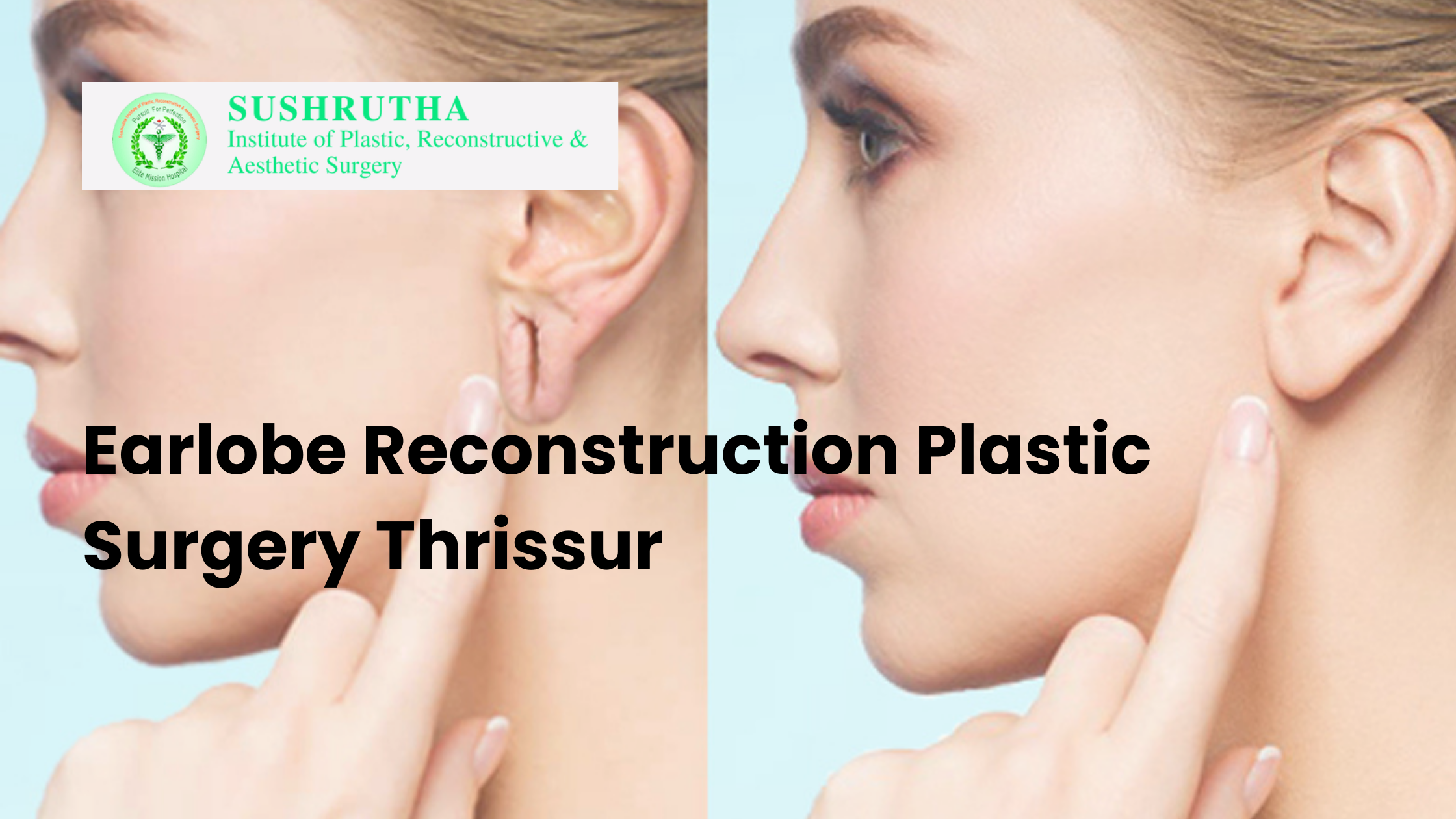 earlobe reconstruction plastic surgery Thrissur