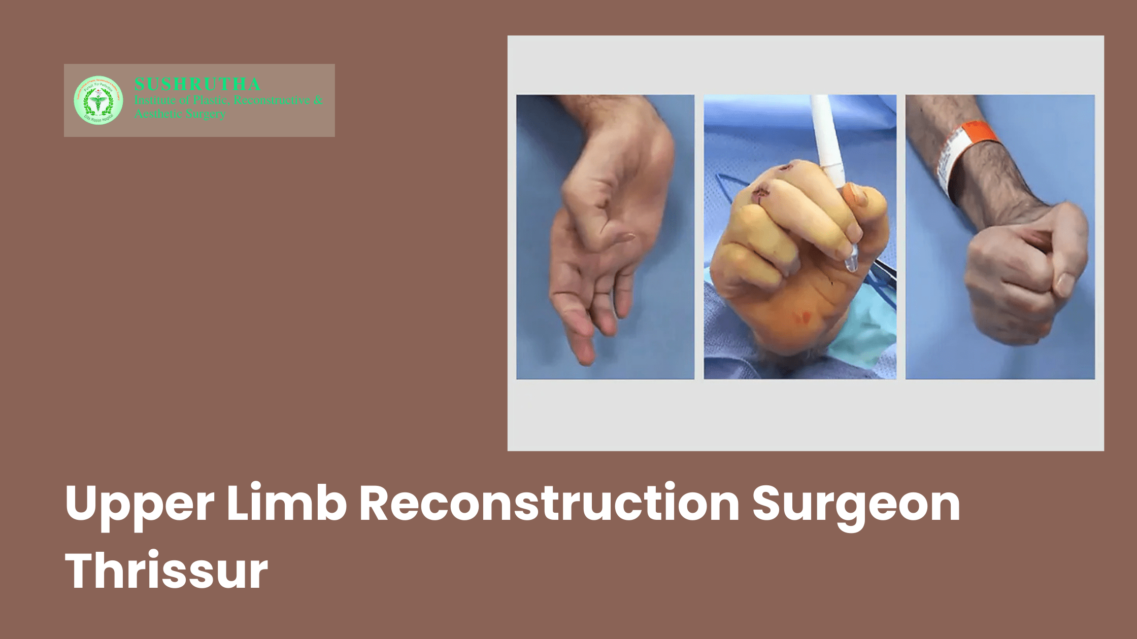 Upper Limb Reconstruction Surgeon Thrissur