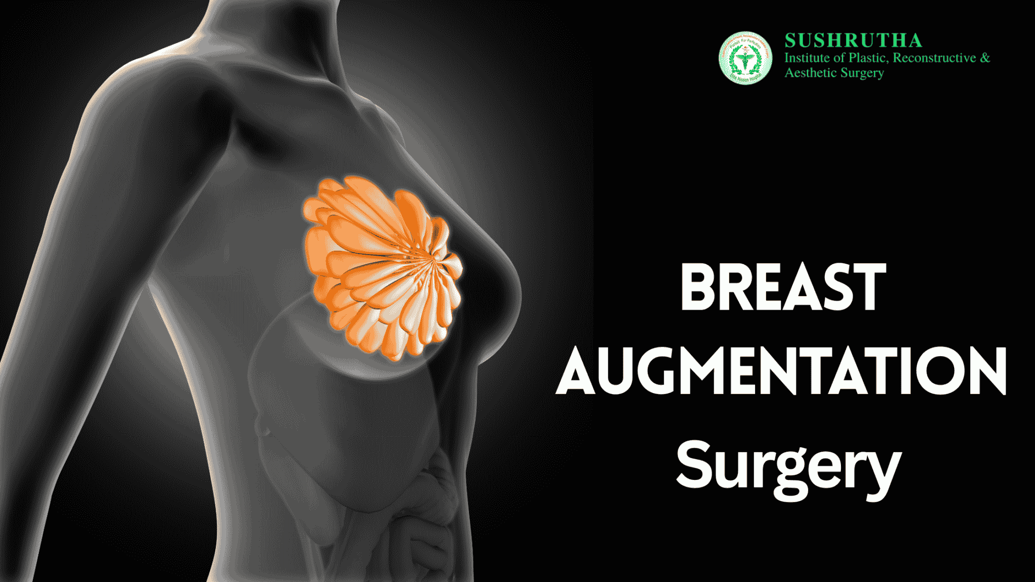 Breast Augmentation Surgery in Thrissur