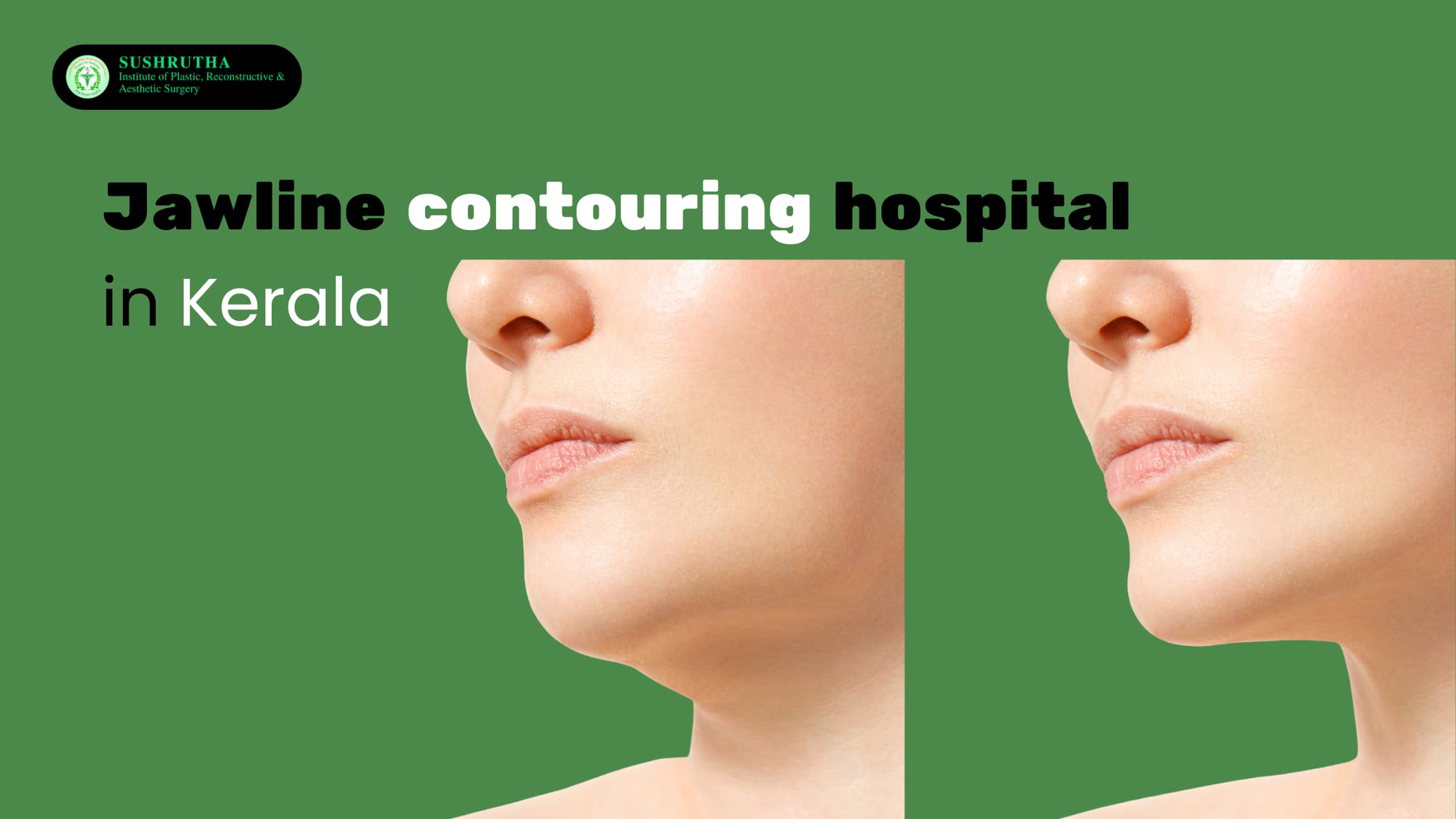Jawline contouring hospital in Kerala