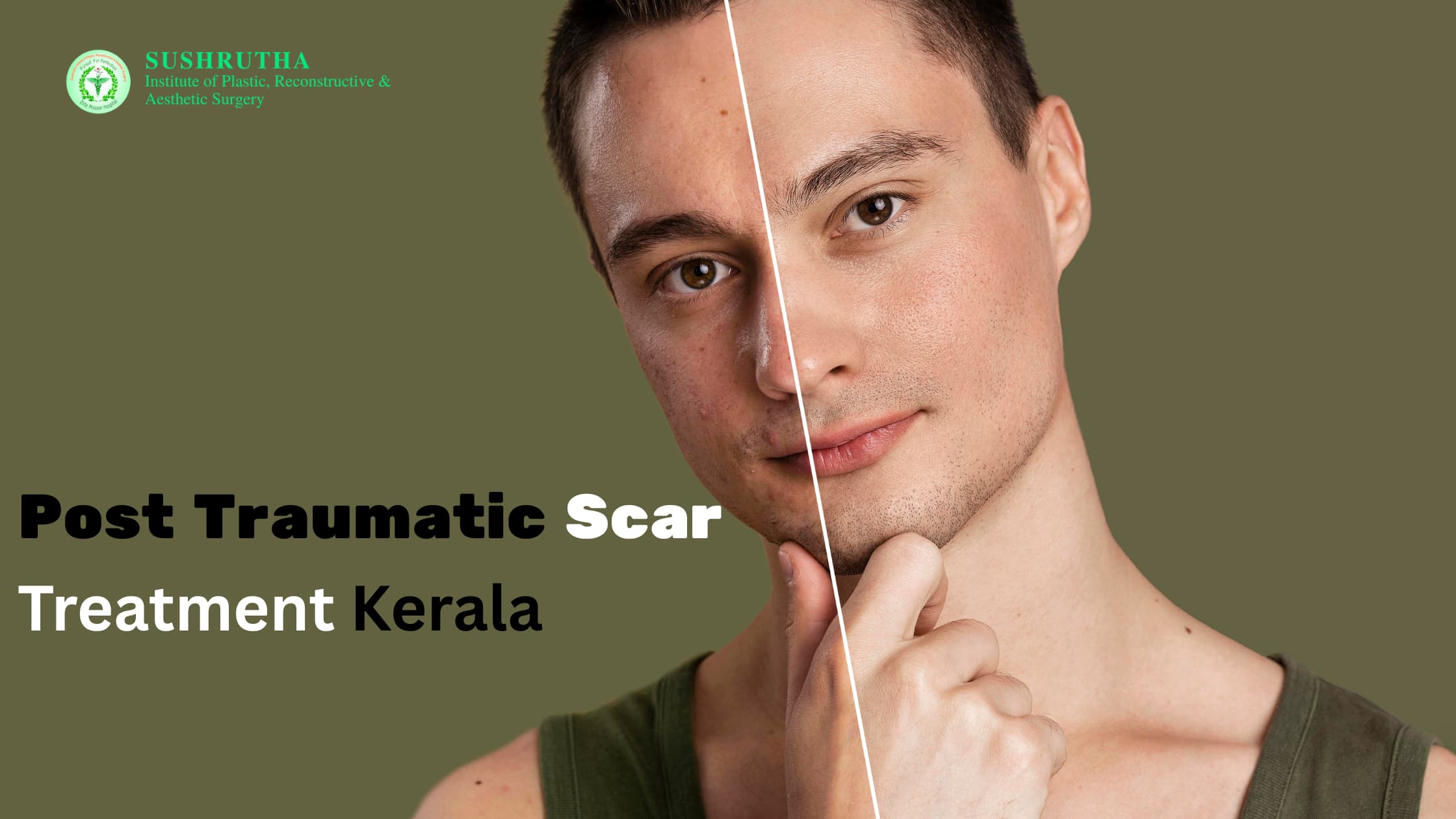 post traumatic scar treatment kerala