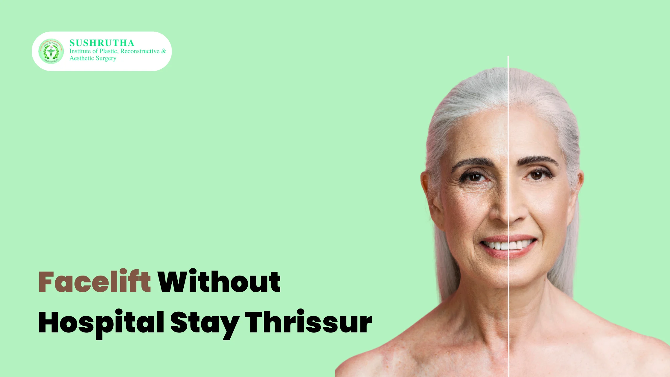 Facelift Without Hospital Stay Thrissur