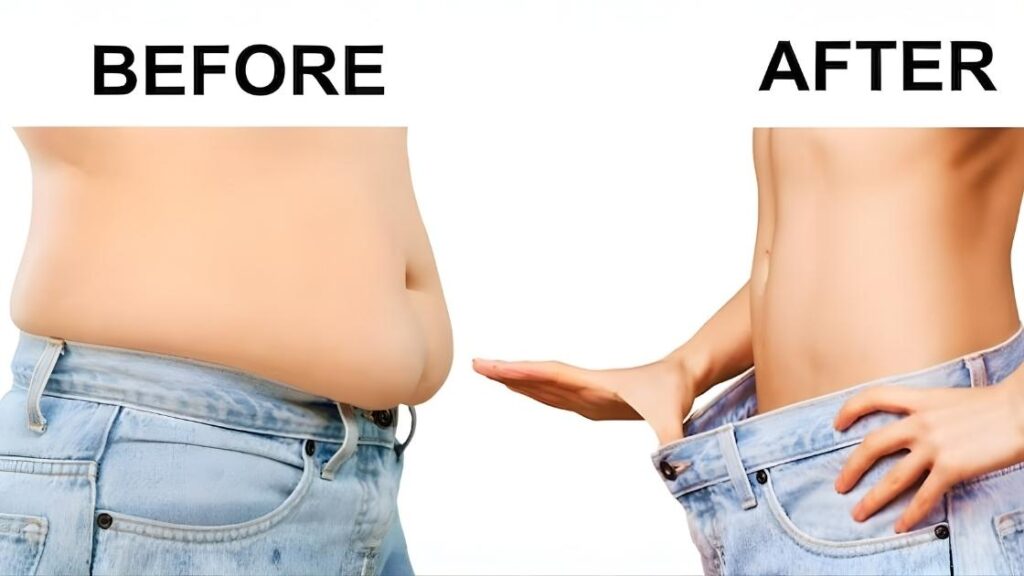 High Definition Liposuction Before and After Results
