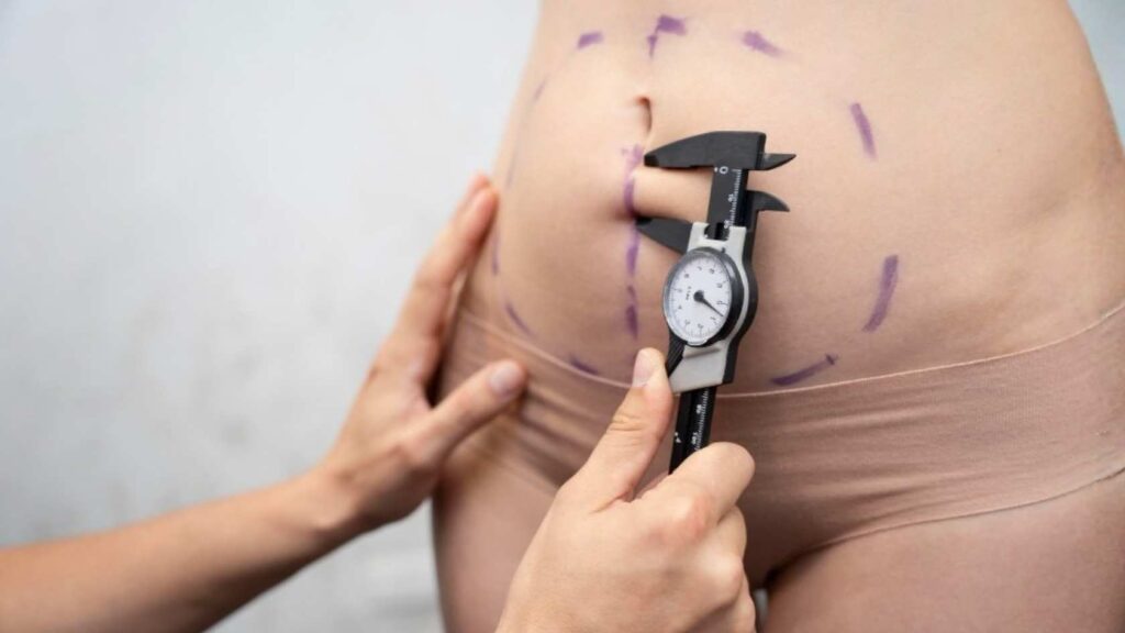 High Definition Liposuction Risks and Complications