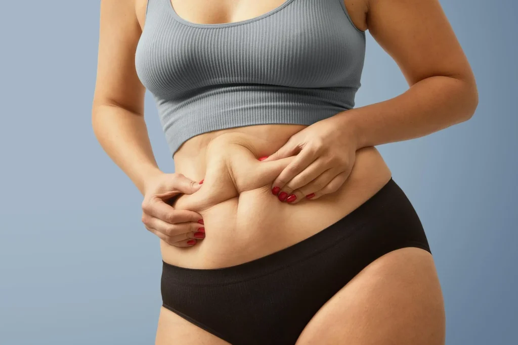 Tummy tuck surgery in Kerala showing abdominal contour correction and excess skin reduction consultation