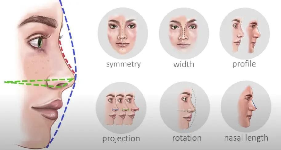 Benefits of Rhinoplasty Surgery illustration showing nasal symmetry, width, profile, projection, rotation, and nasal length assessment.