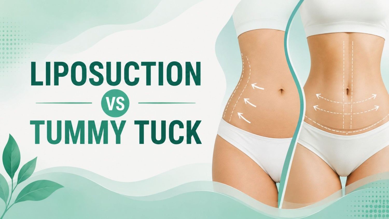 Liposuction vs tummy tuck medical feature image comparing abdominal fat removal and tummy tuck body contouring
